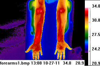 thermogram heat picture of forearms