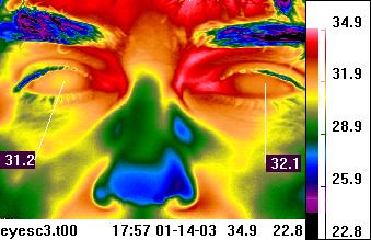 Facial thermal imaging - periorbital
                            region of eyes